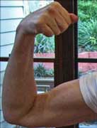 Human arm showing muscles